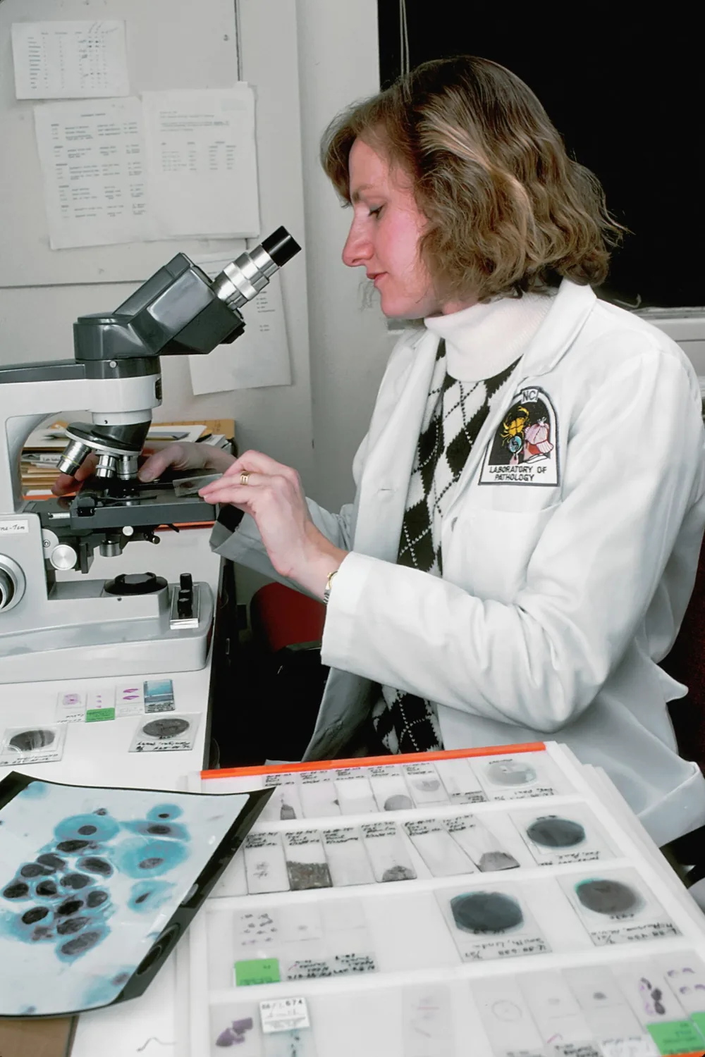 Cytology sample analysis